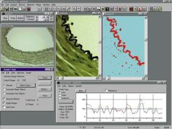 Image Analysis software & Imaging software